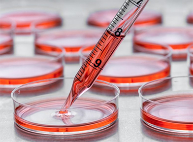 Incubator Shakers application in cell Culture